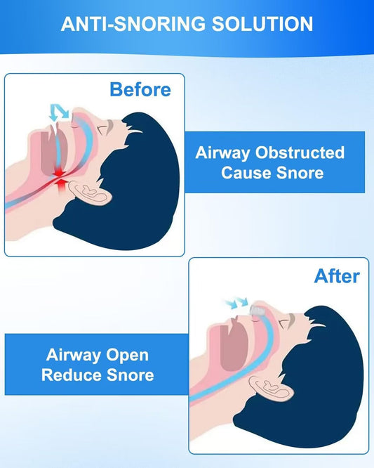 4PCS Silicone Anti Snoring Device